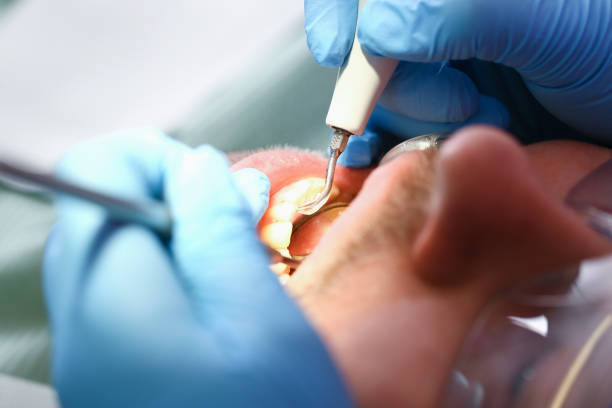 Best Weekend Emergency Dentist in Ithaca, MI