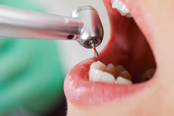 Best Emergency Dental Extractions in Ithaca, MI